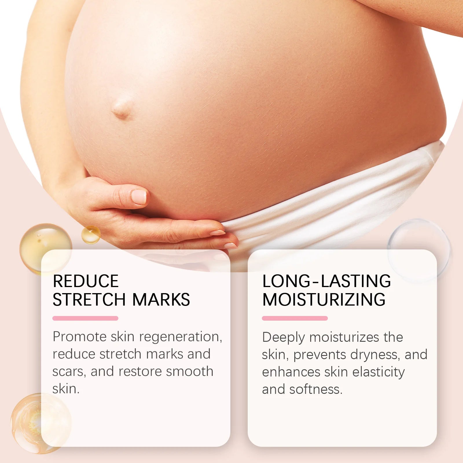 Stretch Mark Removal Cream