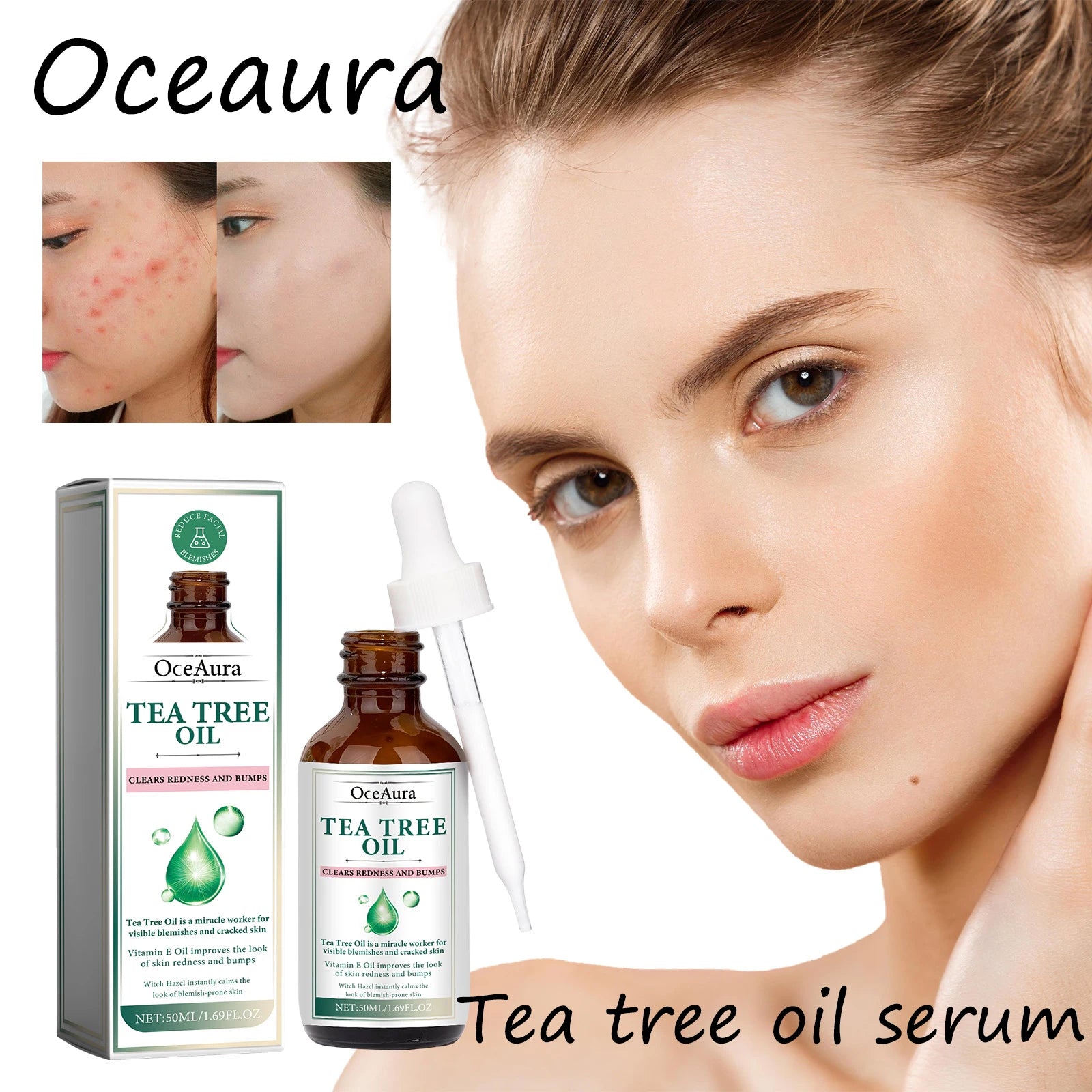 Tea Tree Acne Treatment Serum