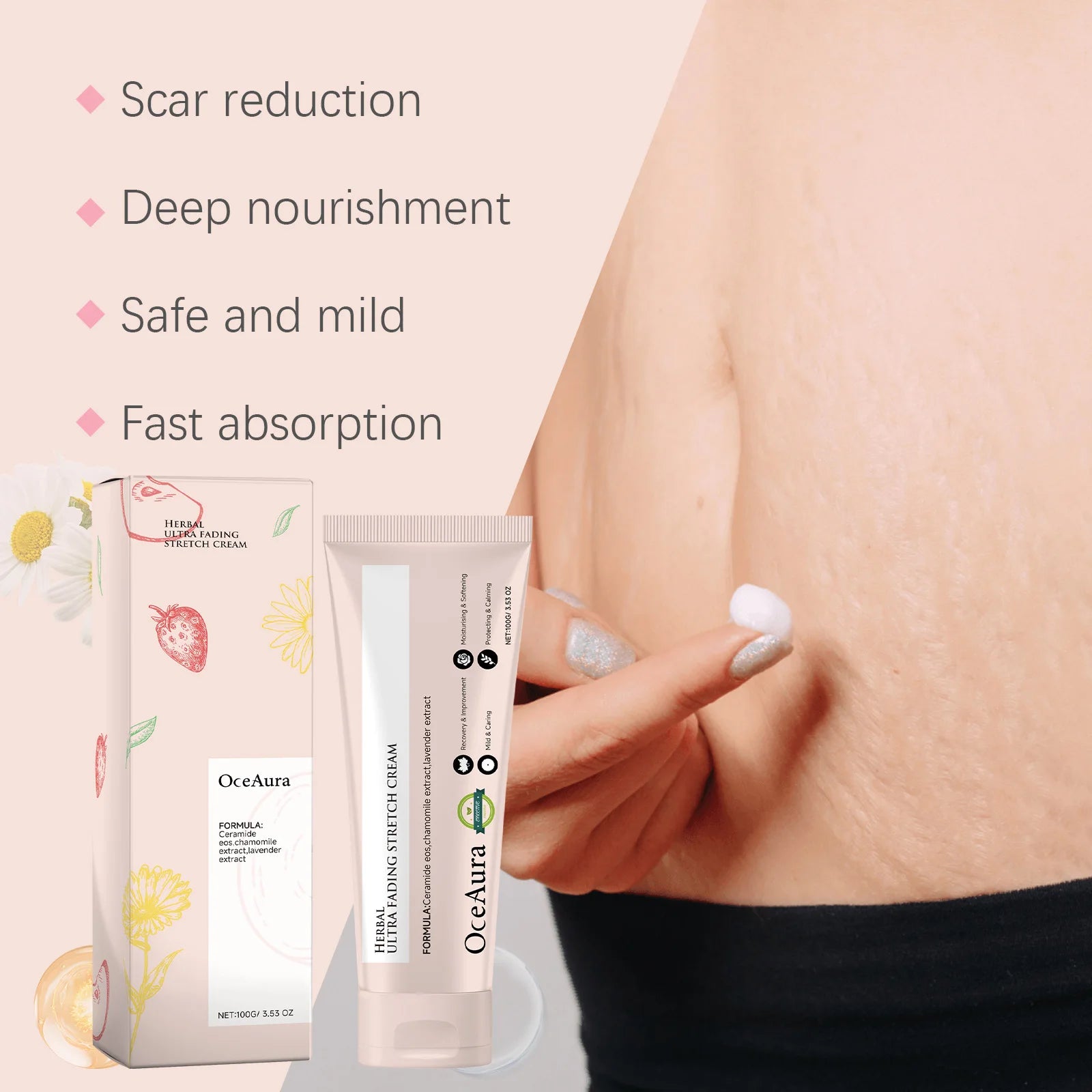 Stretch Mark Removal Cream