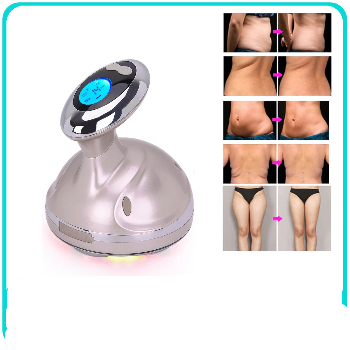 Ultrasonic RF Body Sculpting Cavitation Device