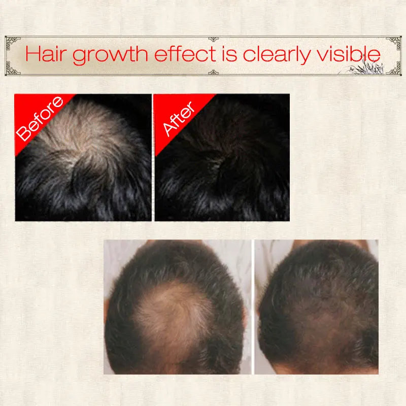 Herbal Hair Growth Spray
