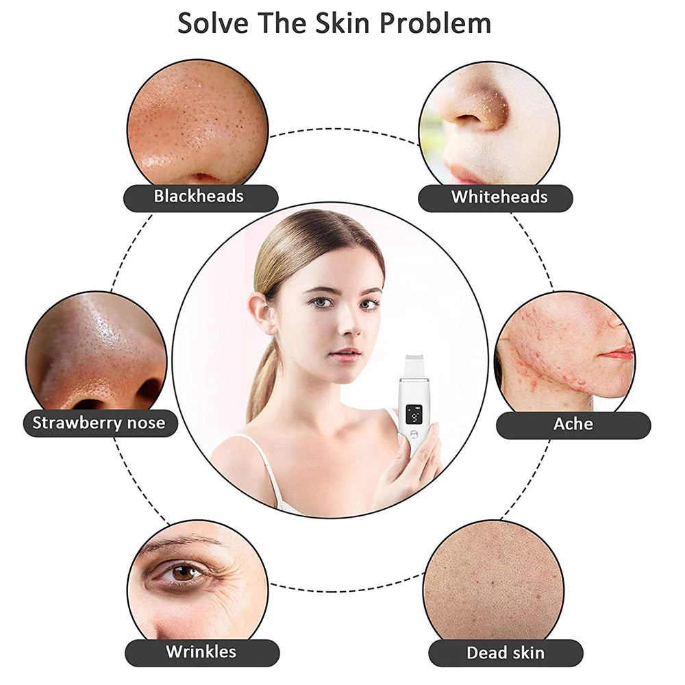Ultrasonic EMS Skin Scrubber Facial Cleaner