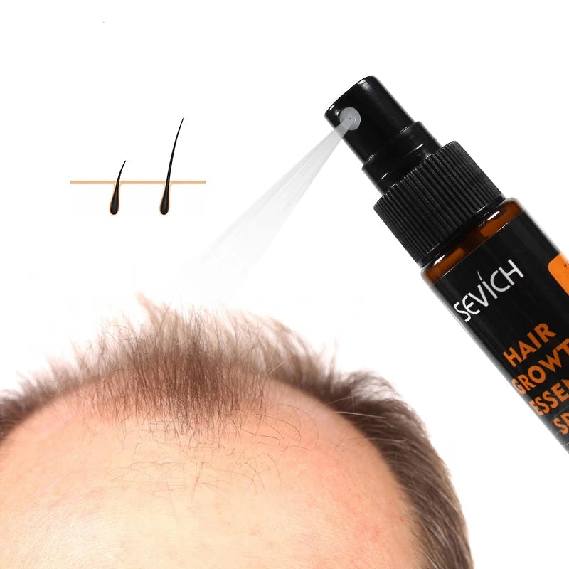 Herbal Hair Growth Spray