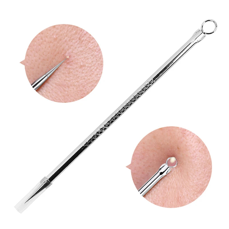 Blackhead & Acne Extractor Tool