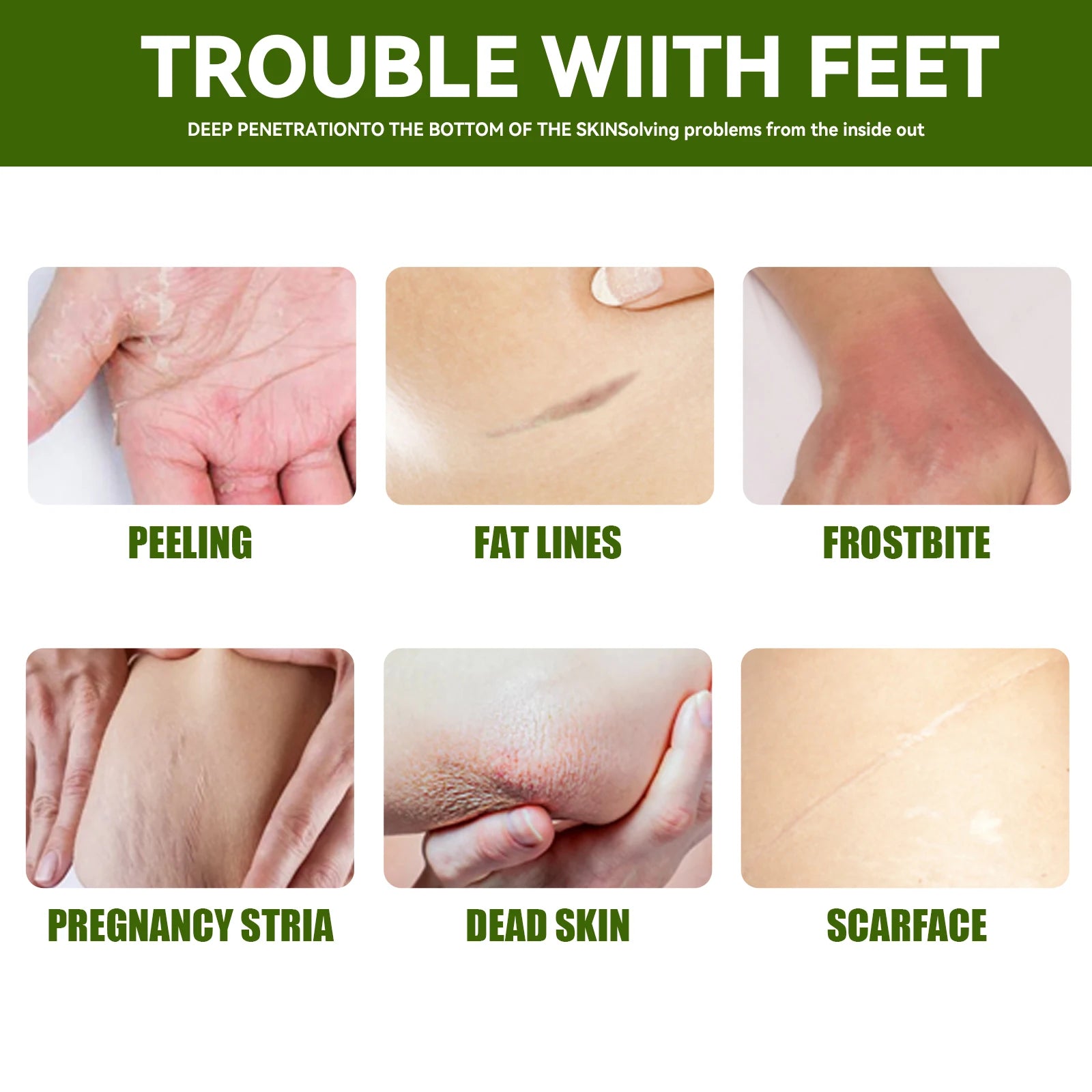 Cracked Heel Repair Foot Cream
