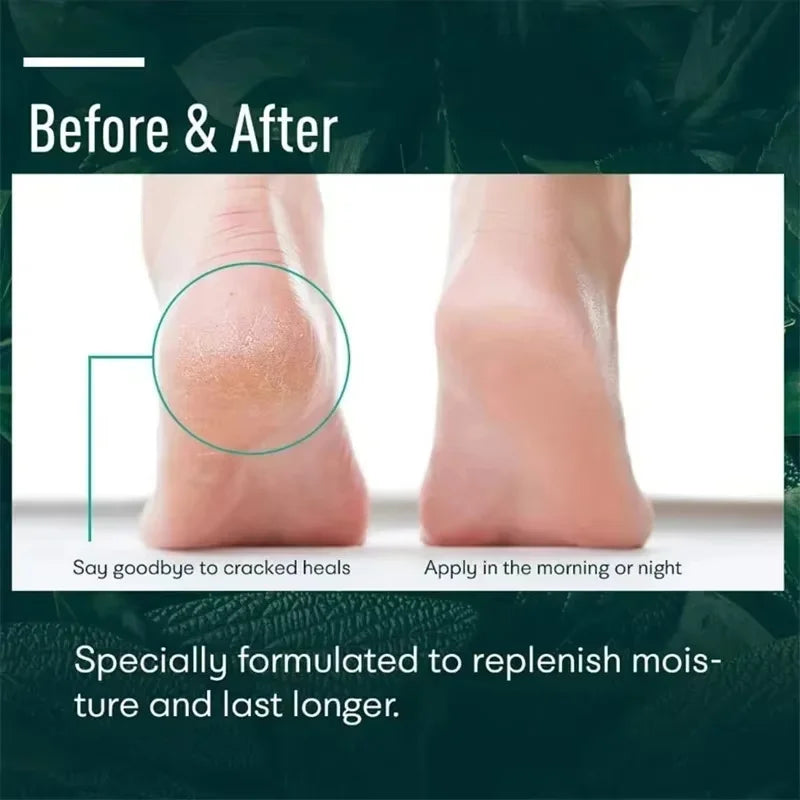Cracked Heel Repair Foot Cream