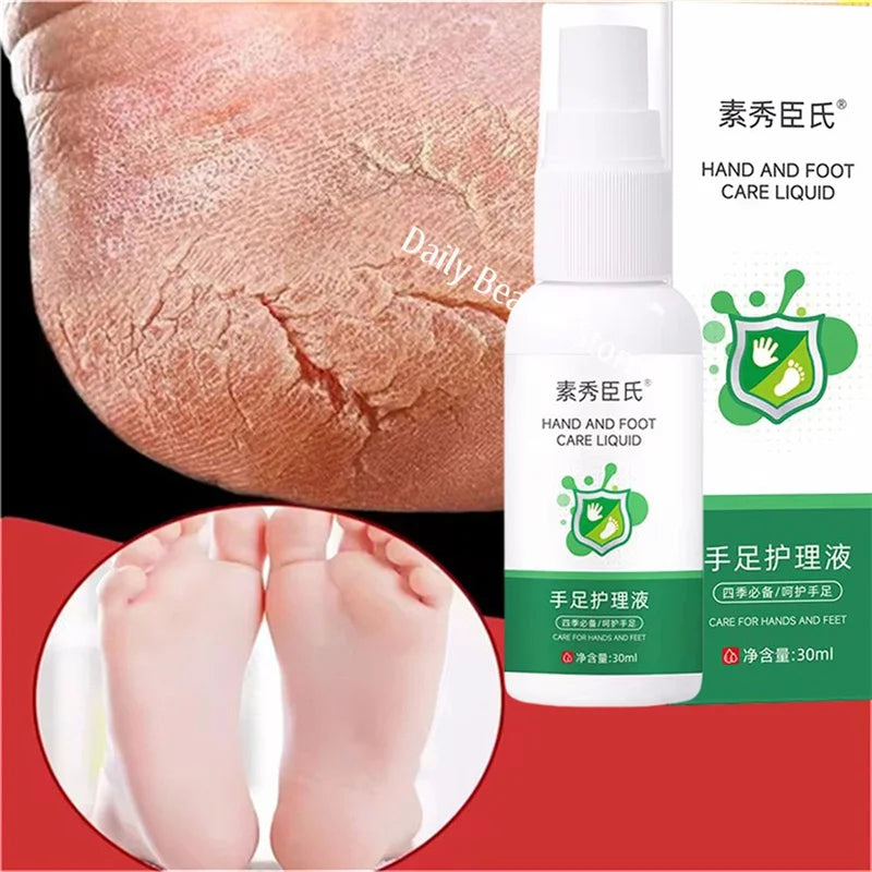 Herbal Anti-Crack Foot Cream Spray