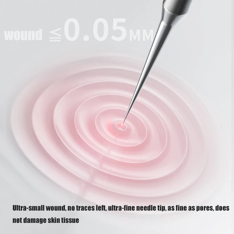 German Blackhead Acne Removal Tool