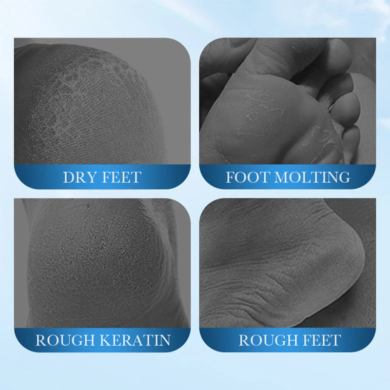 Coconut Foot Peeling Mask