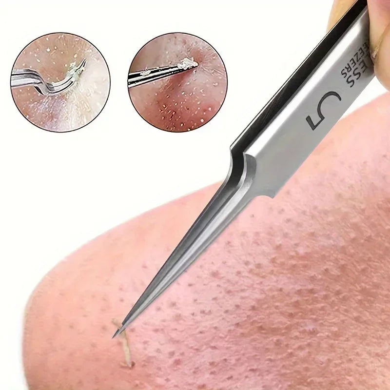 5 Blackhead Tweezers for Acne Removal Tool