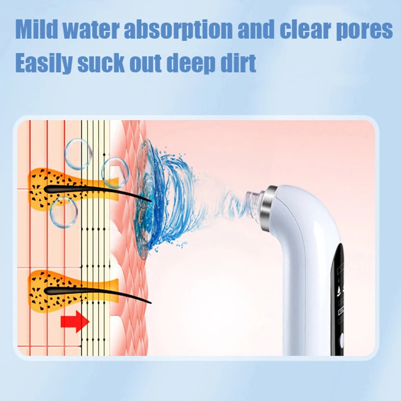 USB Rechargeable Blackhead Remover Vacuum