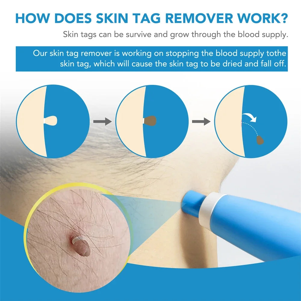 2-in-1 Auto Micro Skin Tag
