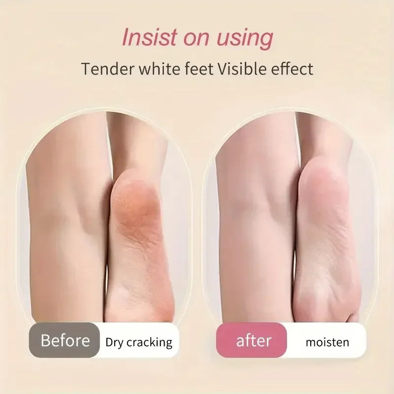 Silicone Moisturizing Foot Care Socks