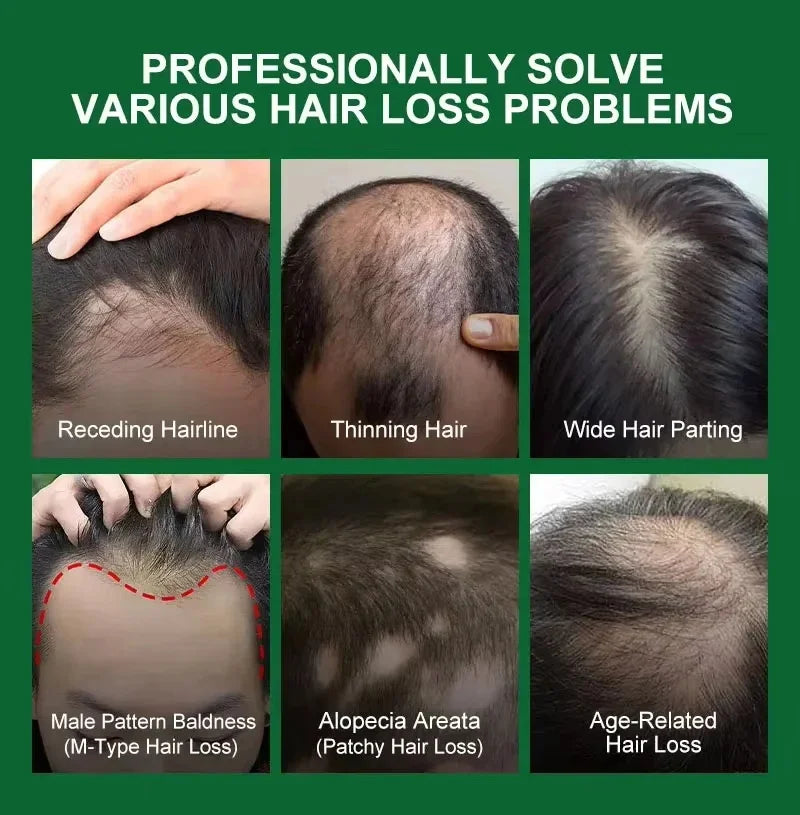 Fast Hair Growth Serum Spray