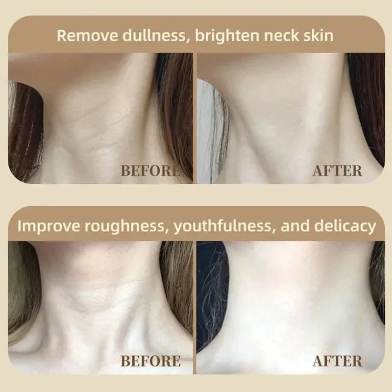 2025 Neck LED Lift Mask