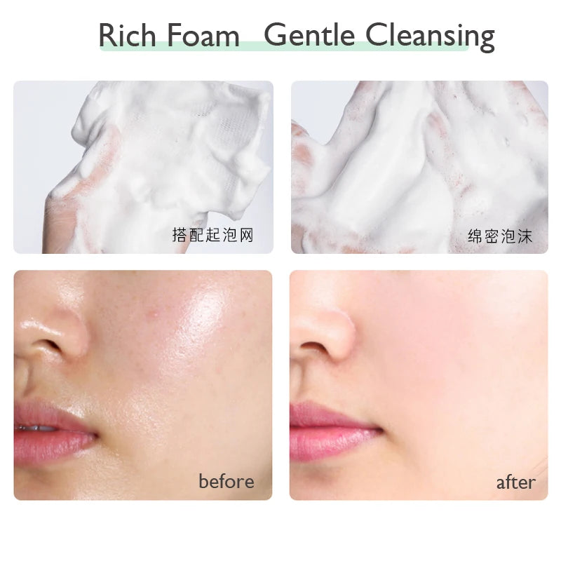 Whitening Facial Cleanser