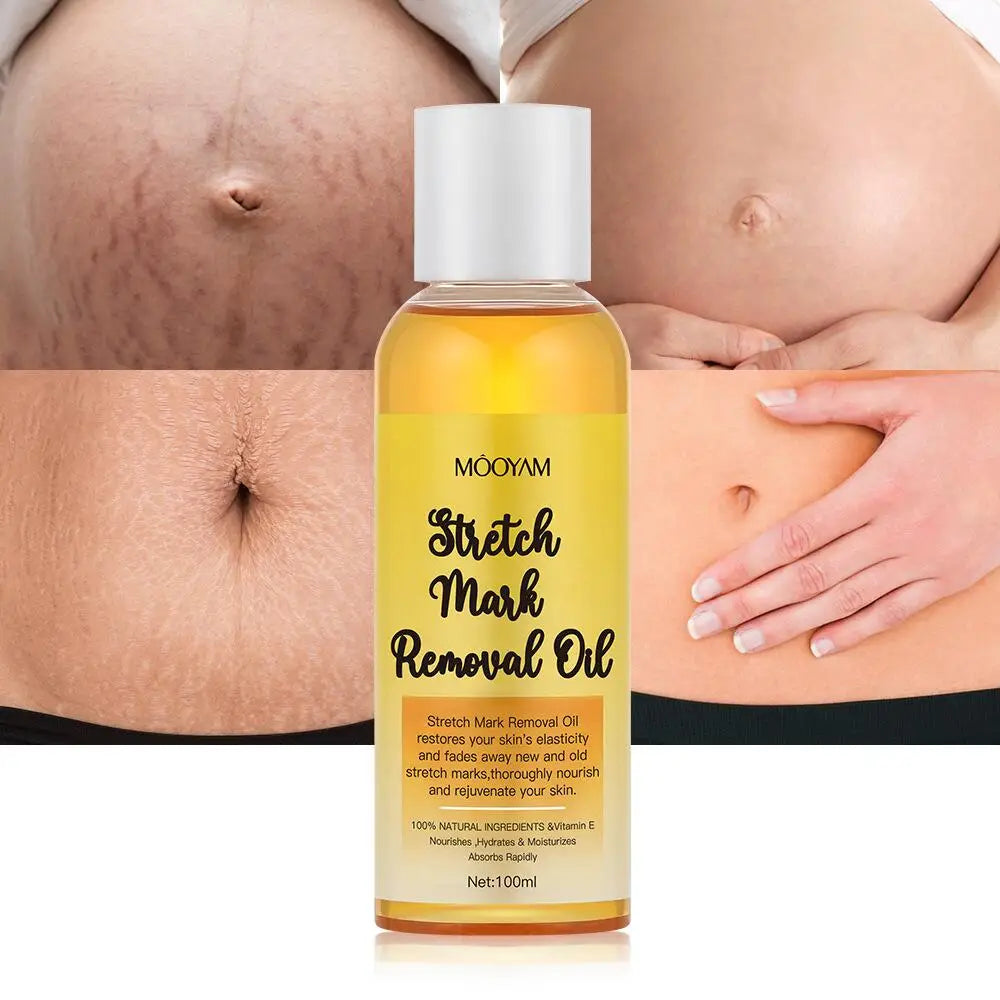 Advanced Stretch Mark Removal Oil