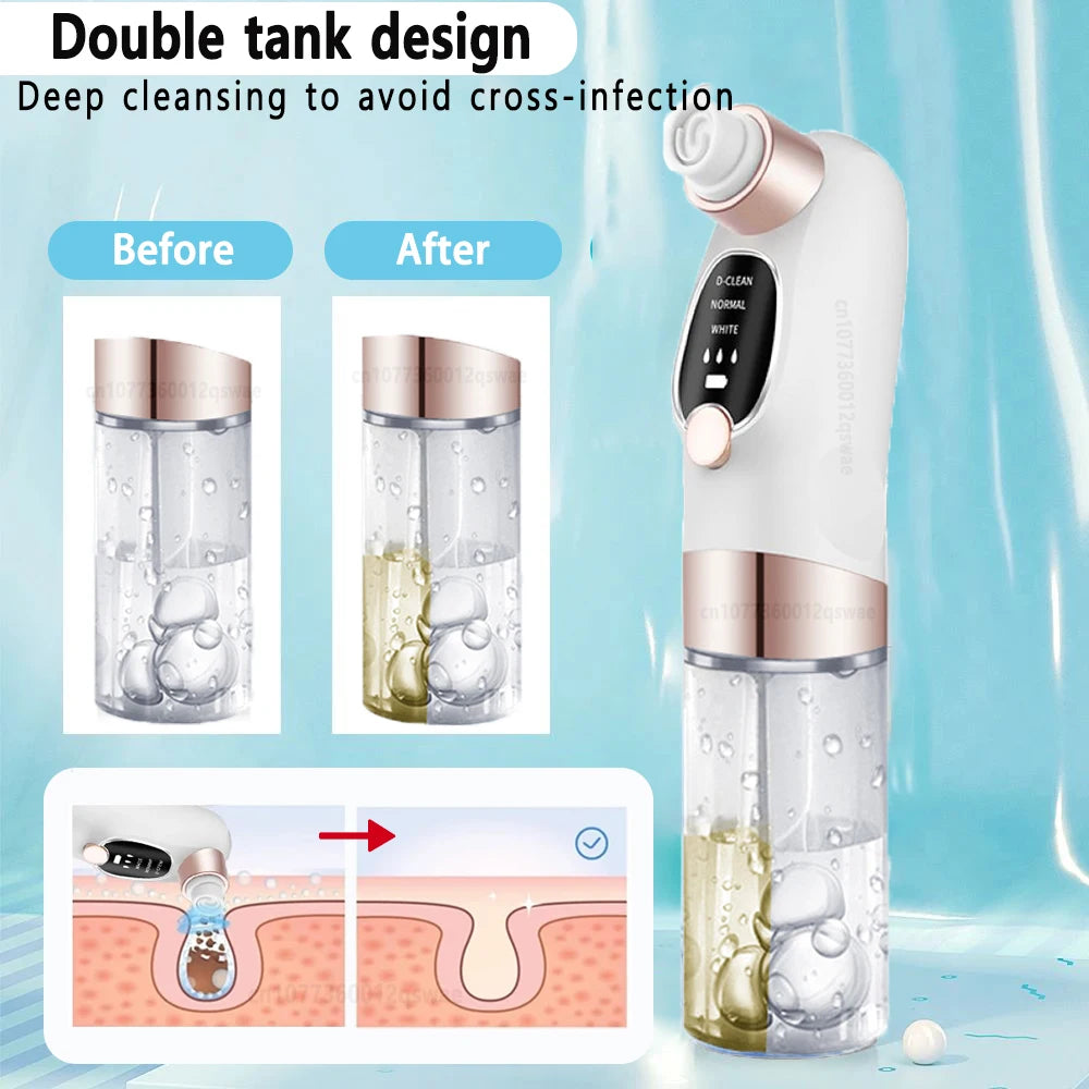 Rechargeable Blackhead Remover Vacuum