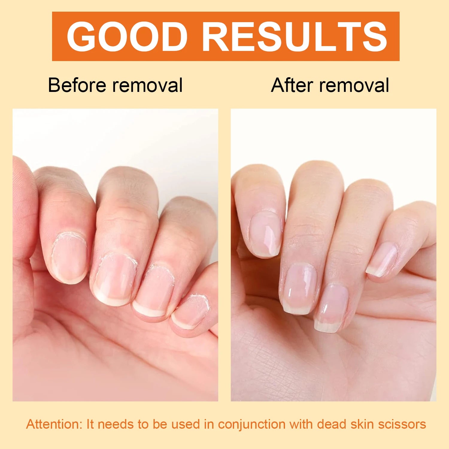 Cuticle Softener Remover Cream