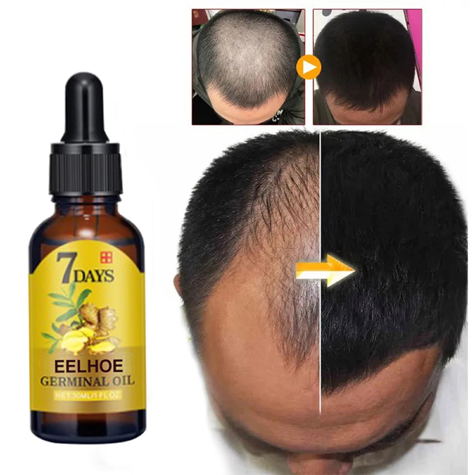 Ginger Hair Growth Oil