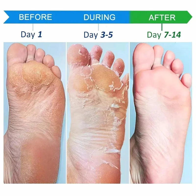 Herbal Anti-Crack Foot Cream Spray