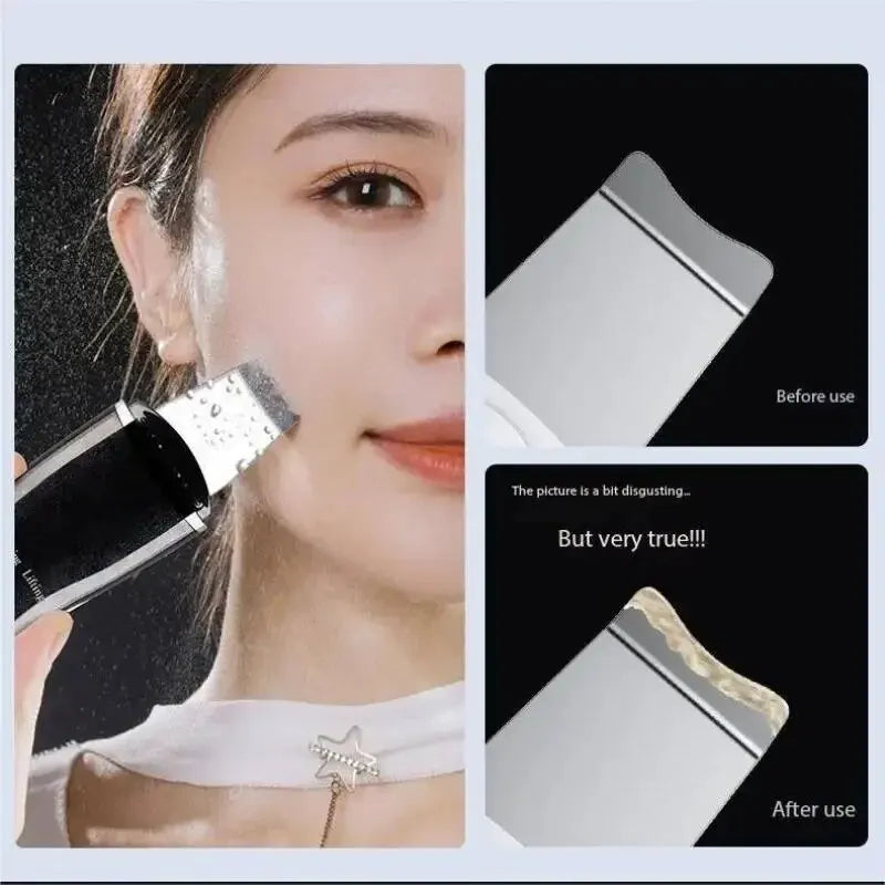 Blackhead Remover Pore Cleaner Device