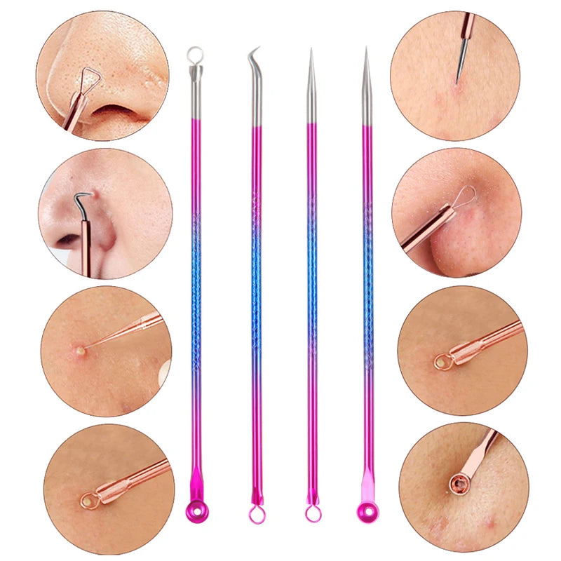 4PCS Acne Blackhead Remover Set
