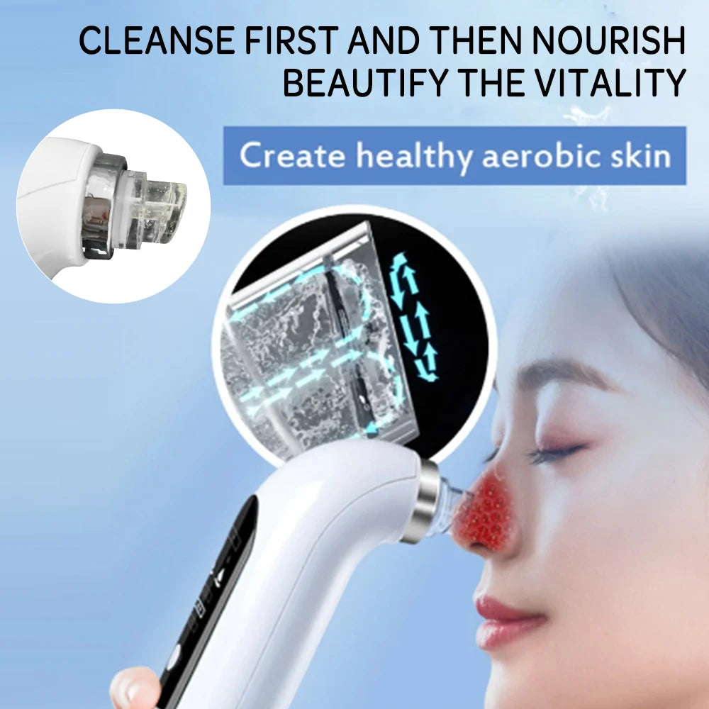 USB Rechargeable Blackhead Remover Vacuum