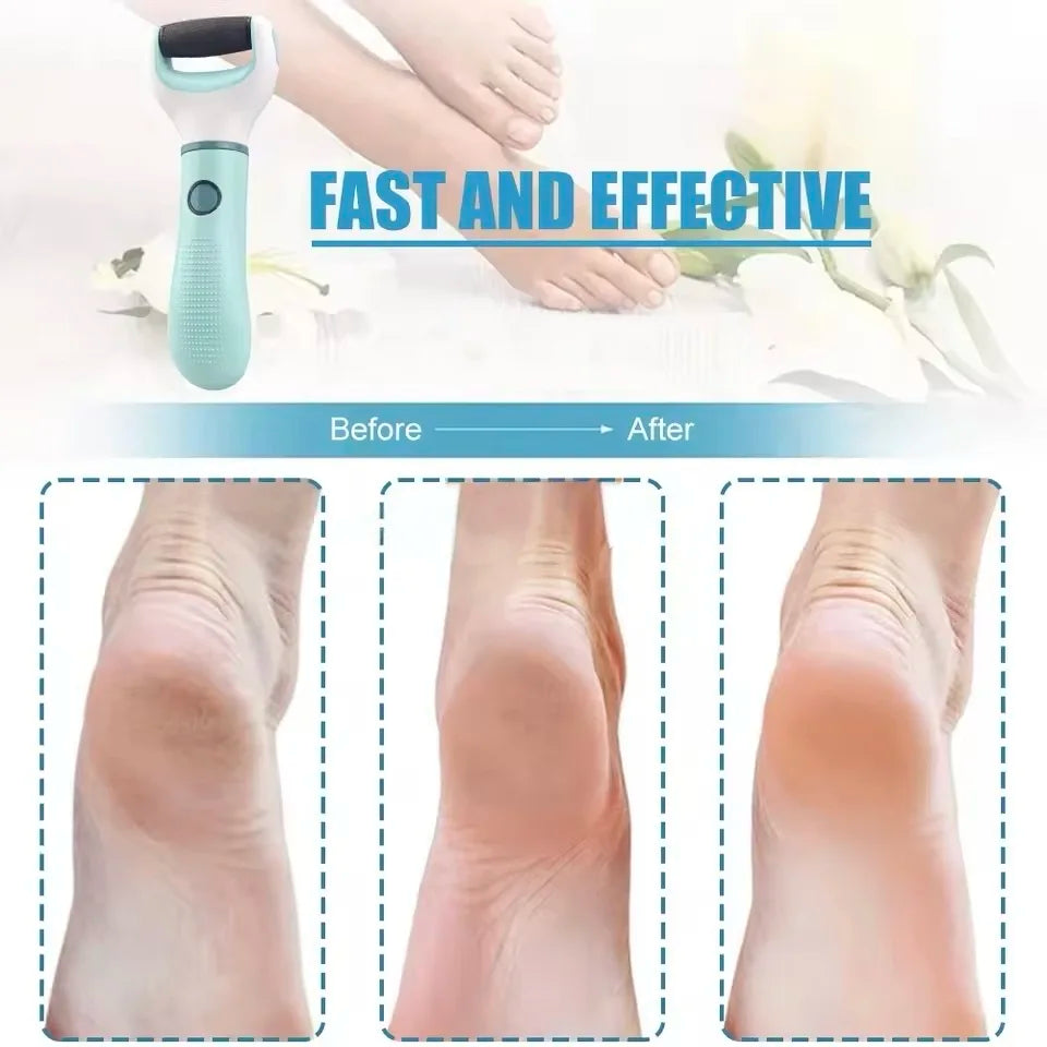 Rechargeable Waterproof Electric Foot Callus Remover Kit
