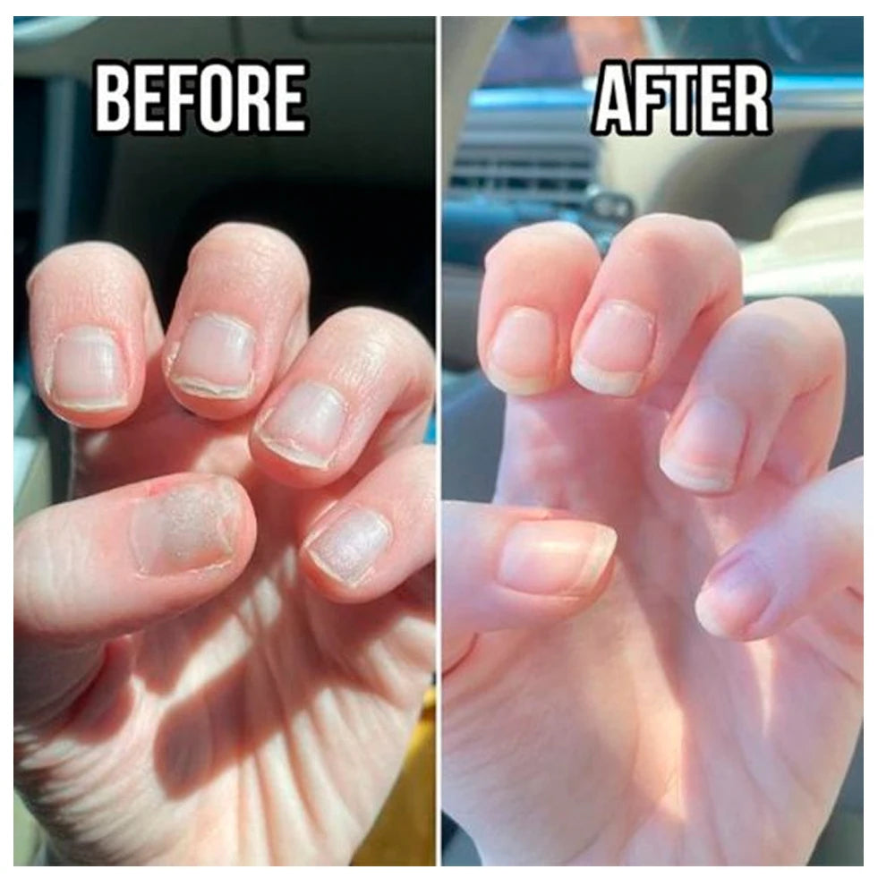 Keratin Nail Treatment Growth Formula