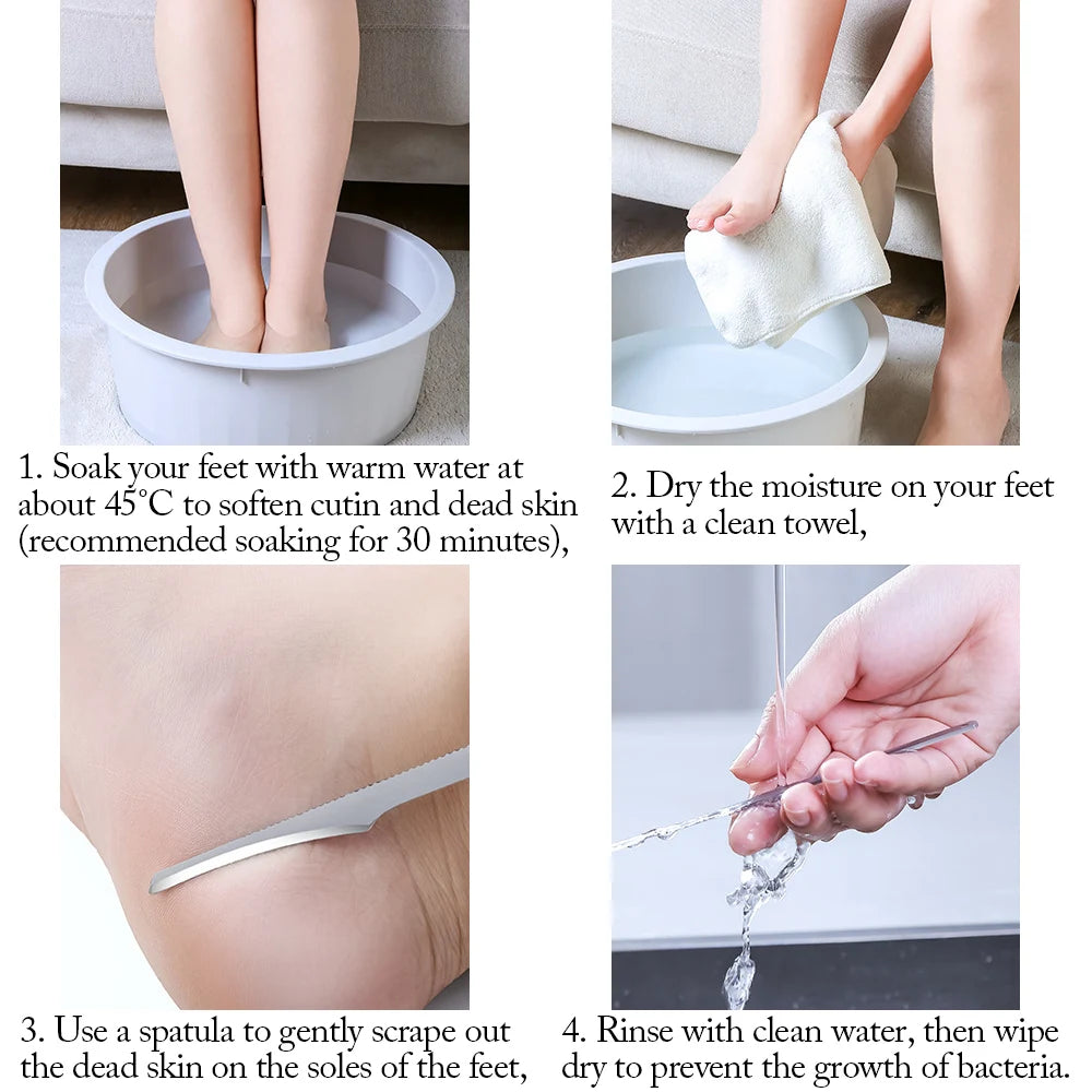 Stainless Steel Pedicure Knife Foot Scraper Set