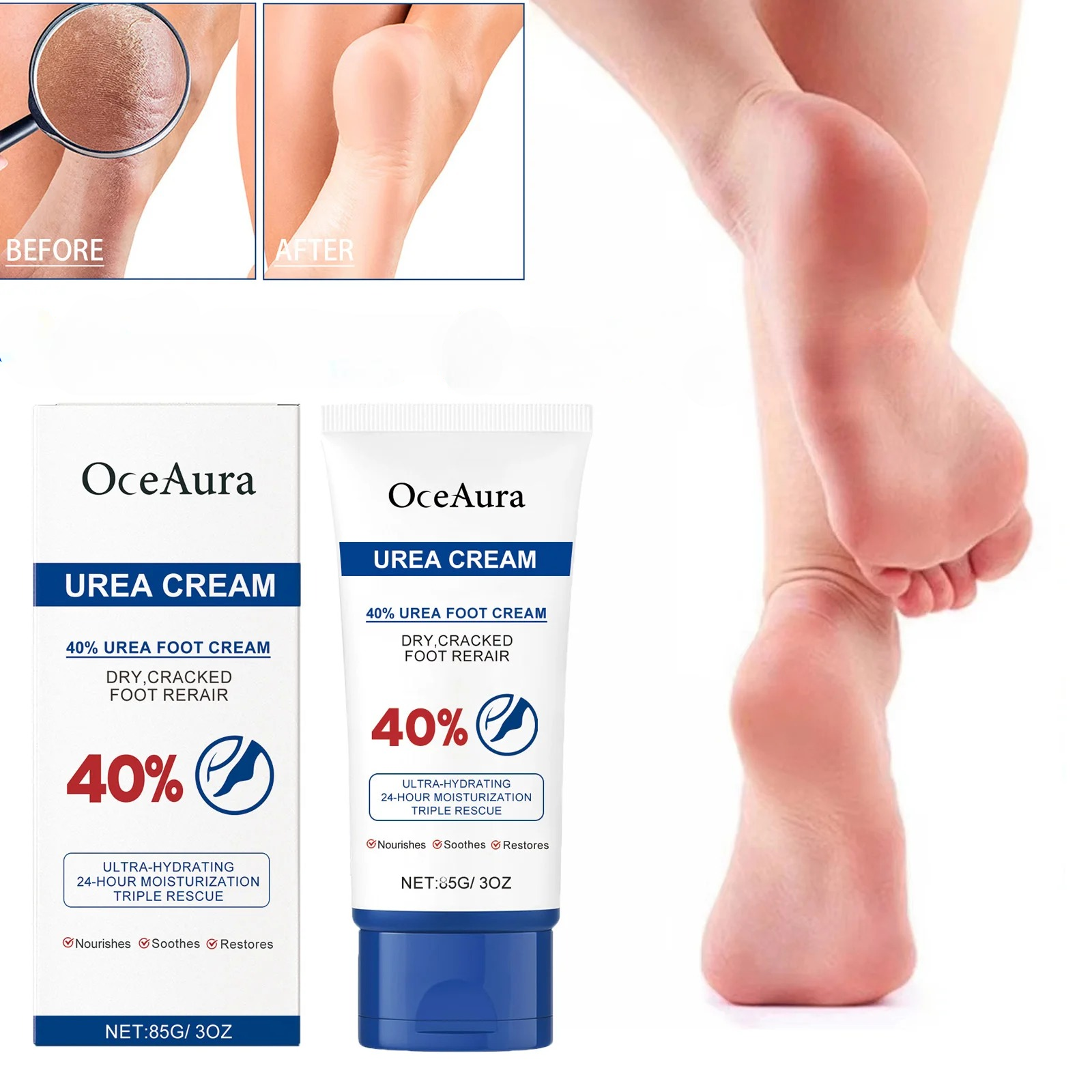40% Urea Foot Cream