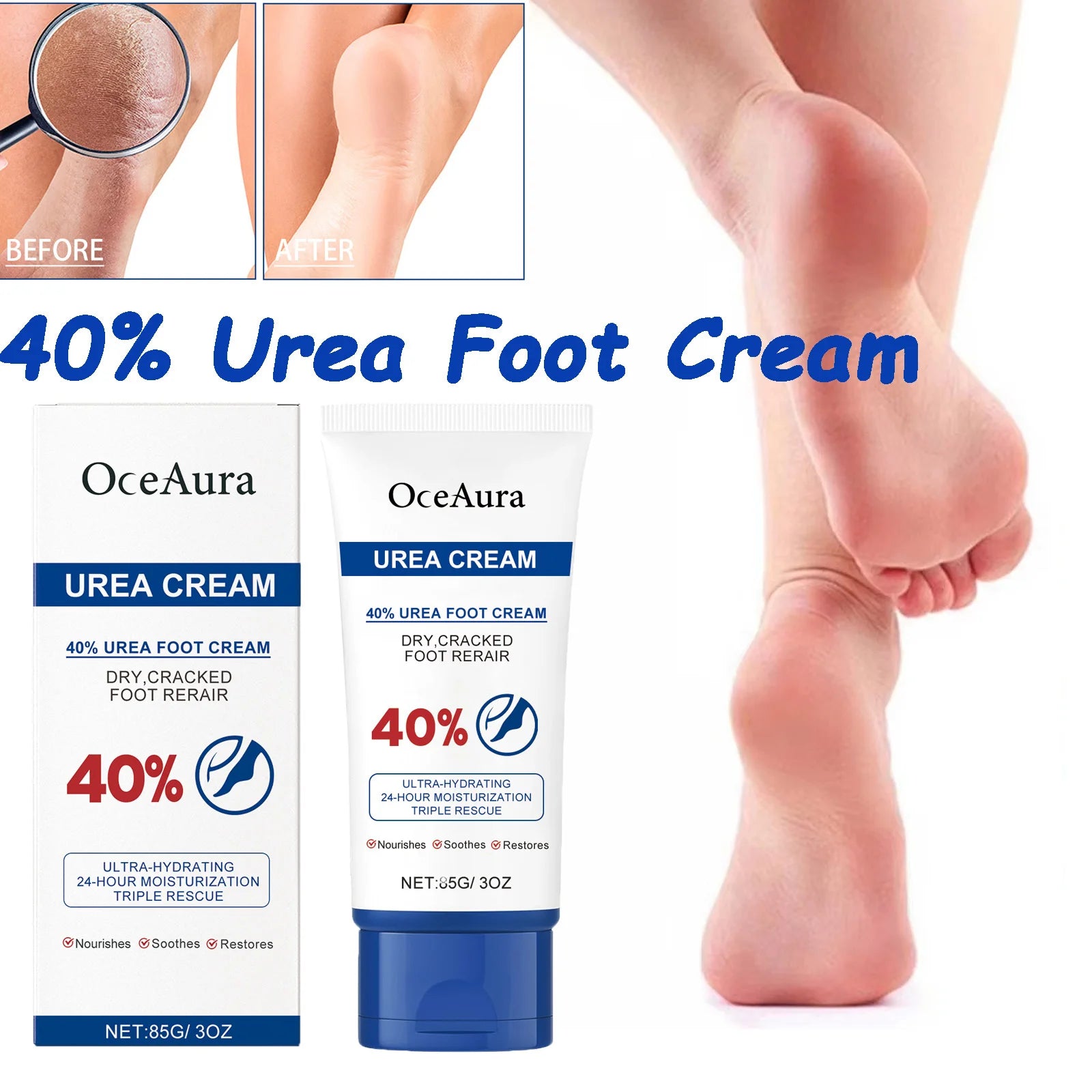 40% Urea Foot Cream