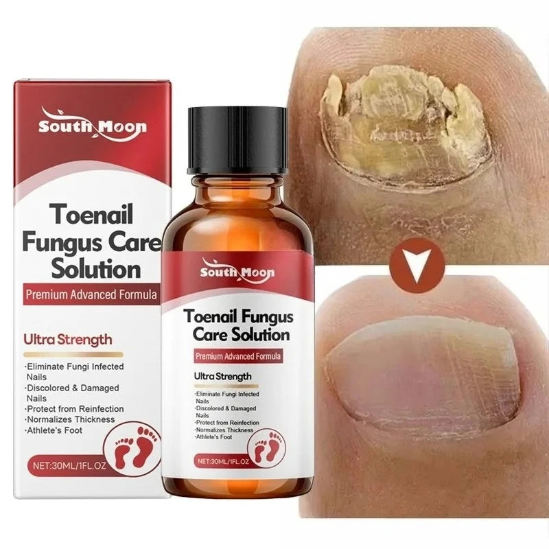 Advanced Fungal Nail Treatment Serum