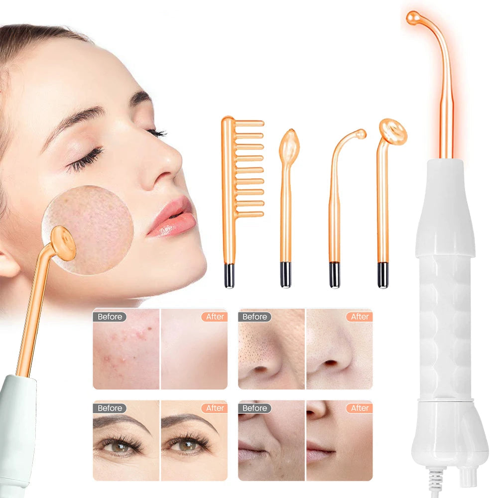 High-Frequency Neon Facial Wand