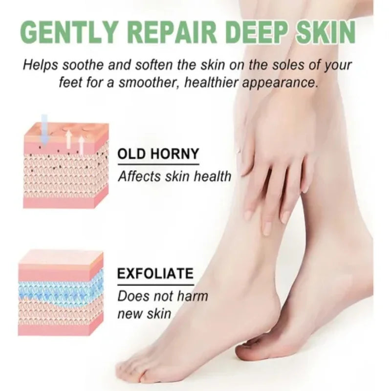 Cracked Heel Repair Foot Cream