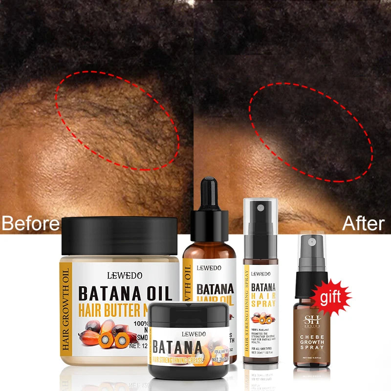 Fast Hair Growth Oil