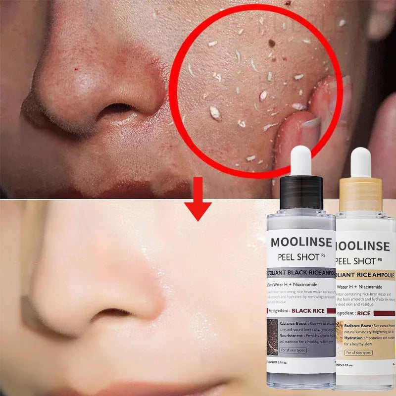 Korean Rice Exfoliating Serum Hydrates