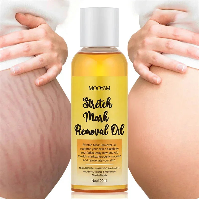 Advanced Stretch Mark Removal Oil