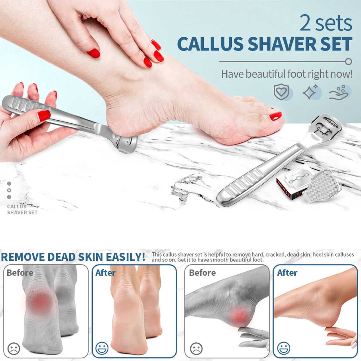 Stainless Steel Foot Scraper and Callus Remover Tool