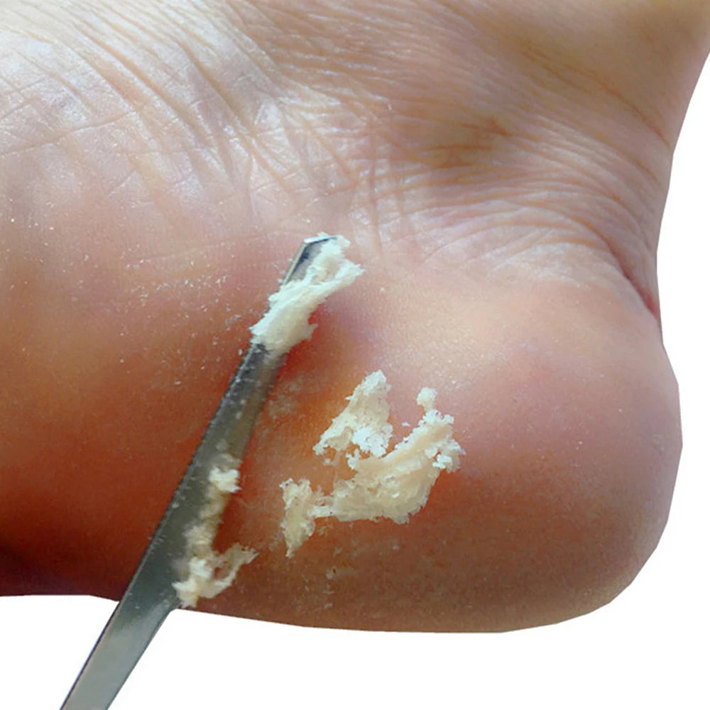 Stainless Steel Pedicure Knife Foot Scraper Set