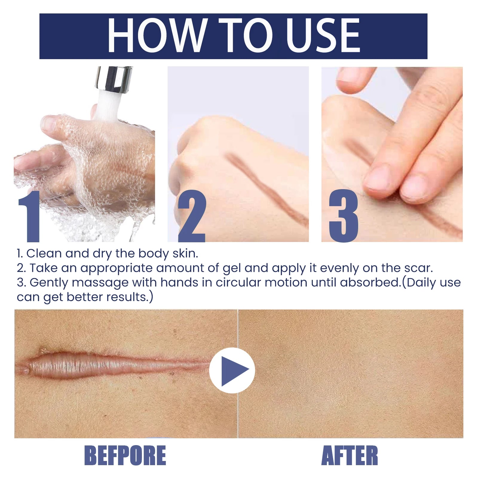 Advanced Silicone Scar Gel