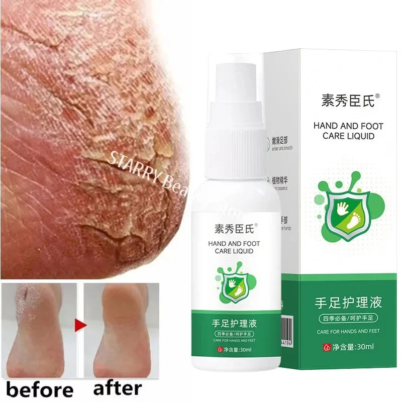Herbal Anti-Crack Foot Cream Spray