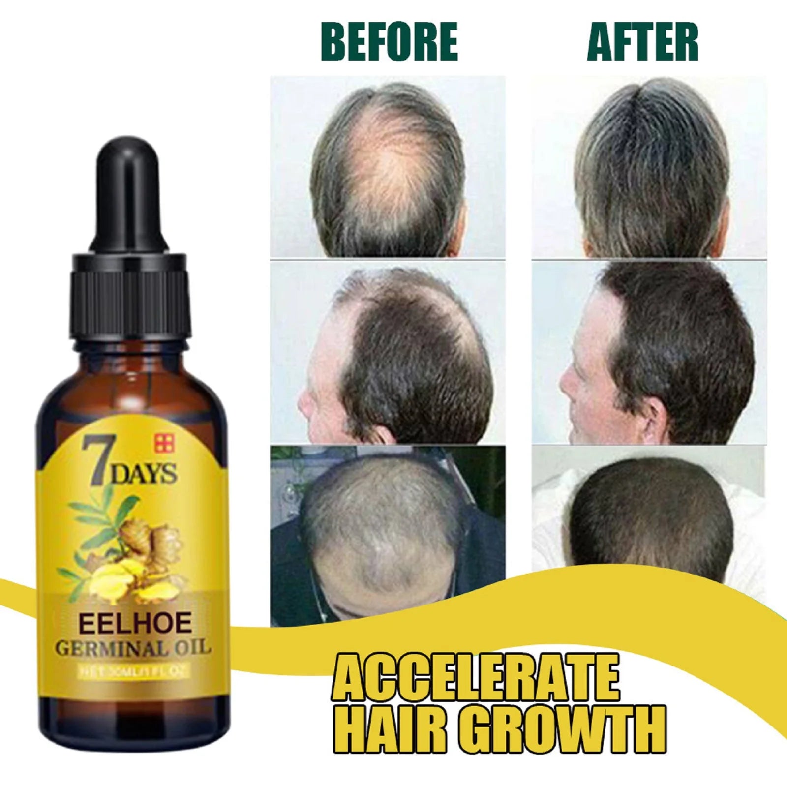 Ginger Hair Growth Oil