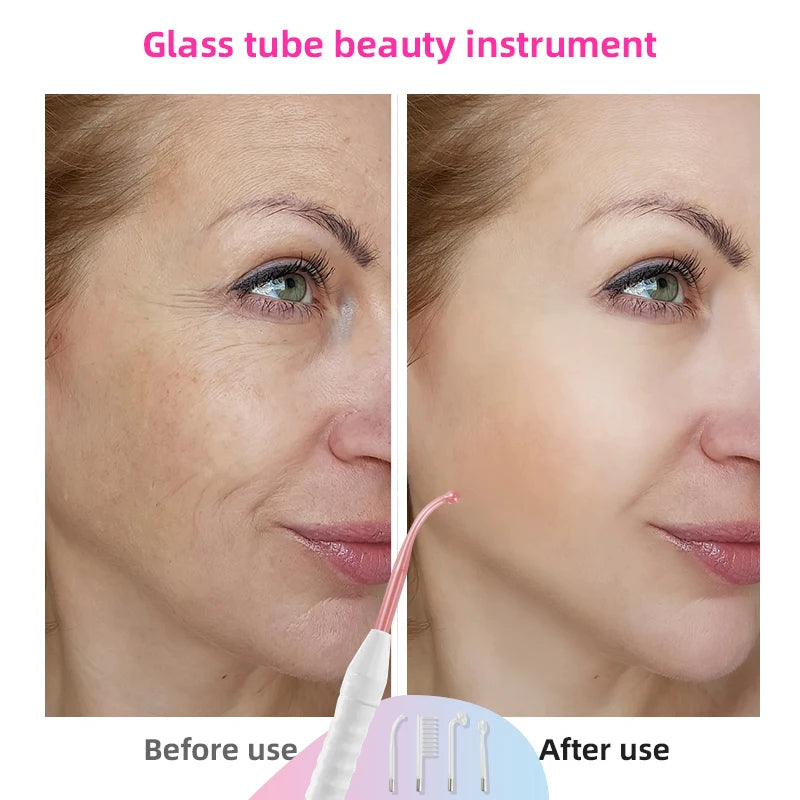 High-Frequency Facial Machine