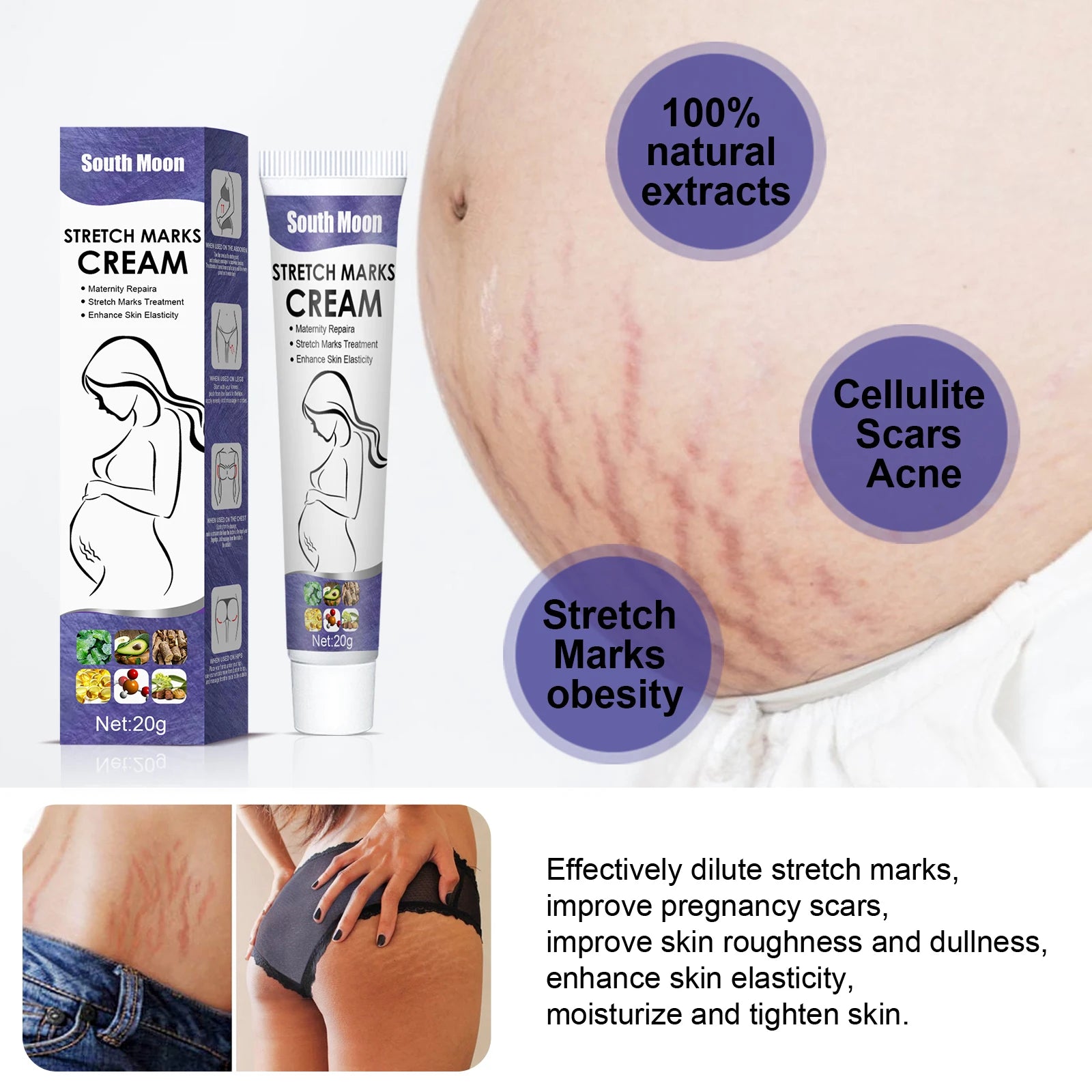 Pregnancy Stretch Mark Cream