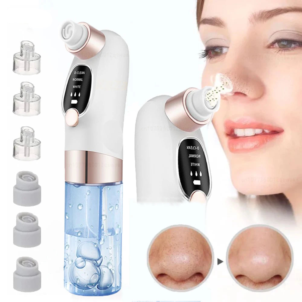 Rechargeable Blackhead Remover Vacuum
