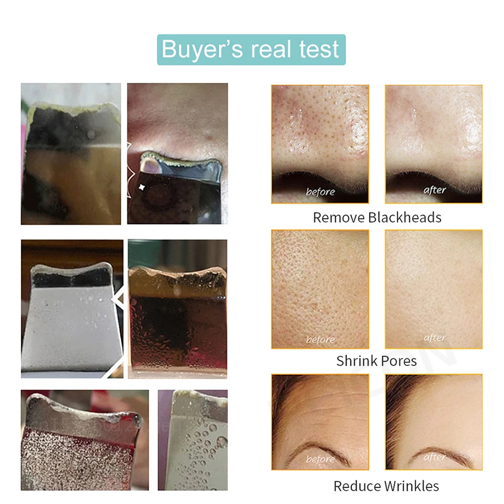 Skin Scrubber for Deep Facial Cleansing