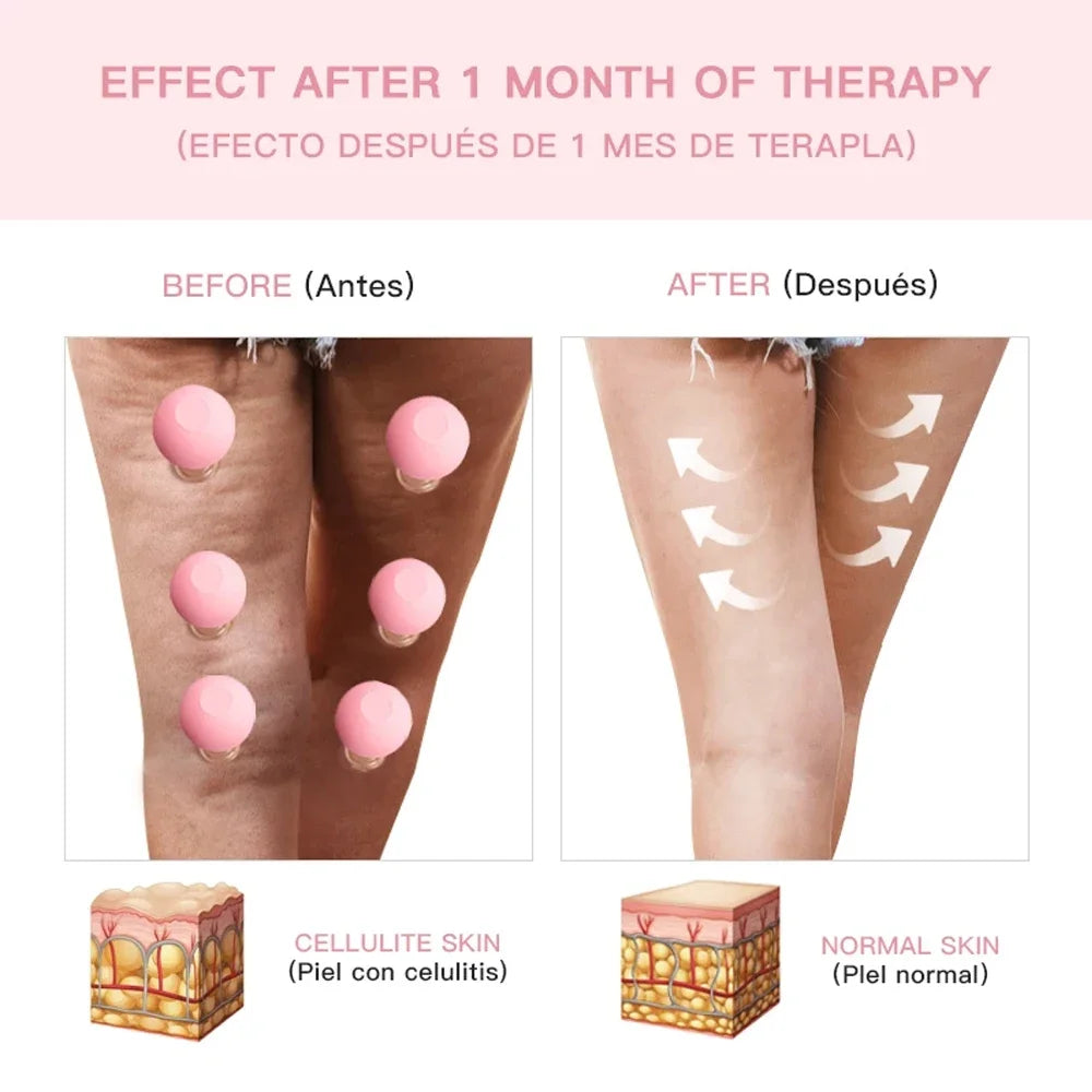 Silicone Facial Cupping Set