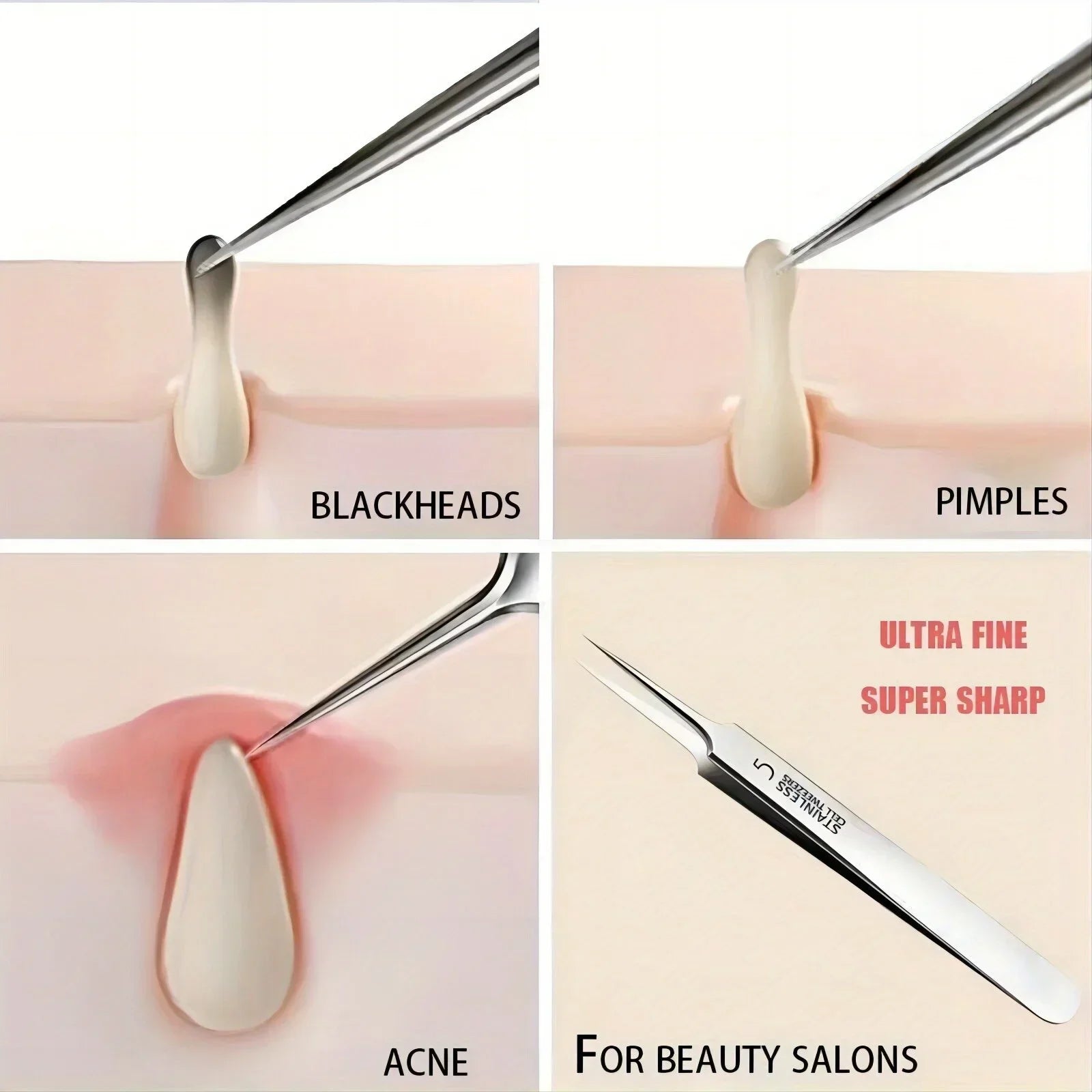 5 Blackhead Tweezers for Acne Removal Tool